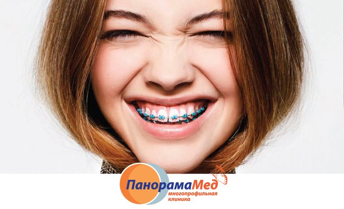 Лечение брекет-системой