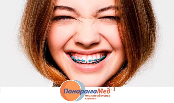 Когда обращаться к ортодонту?