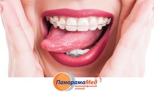 Кривые зубы – мириться или выравнивать? Кривые зубы – мириться или выравнивать?
