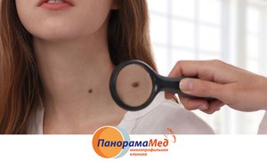 Какие образования на коже не стоит лечить самостоятельно Какие образования на коже не стоит лечить самостоятельно