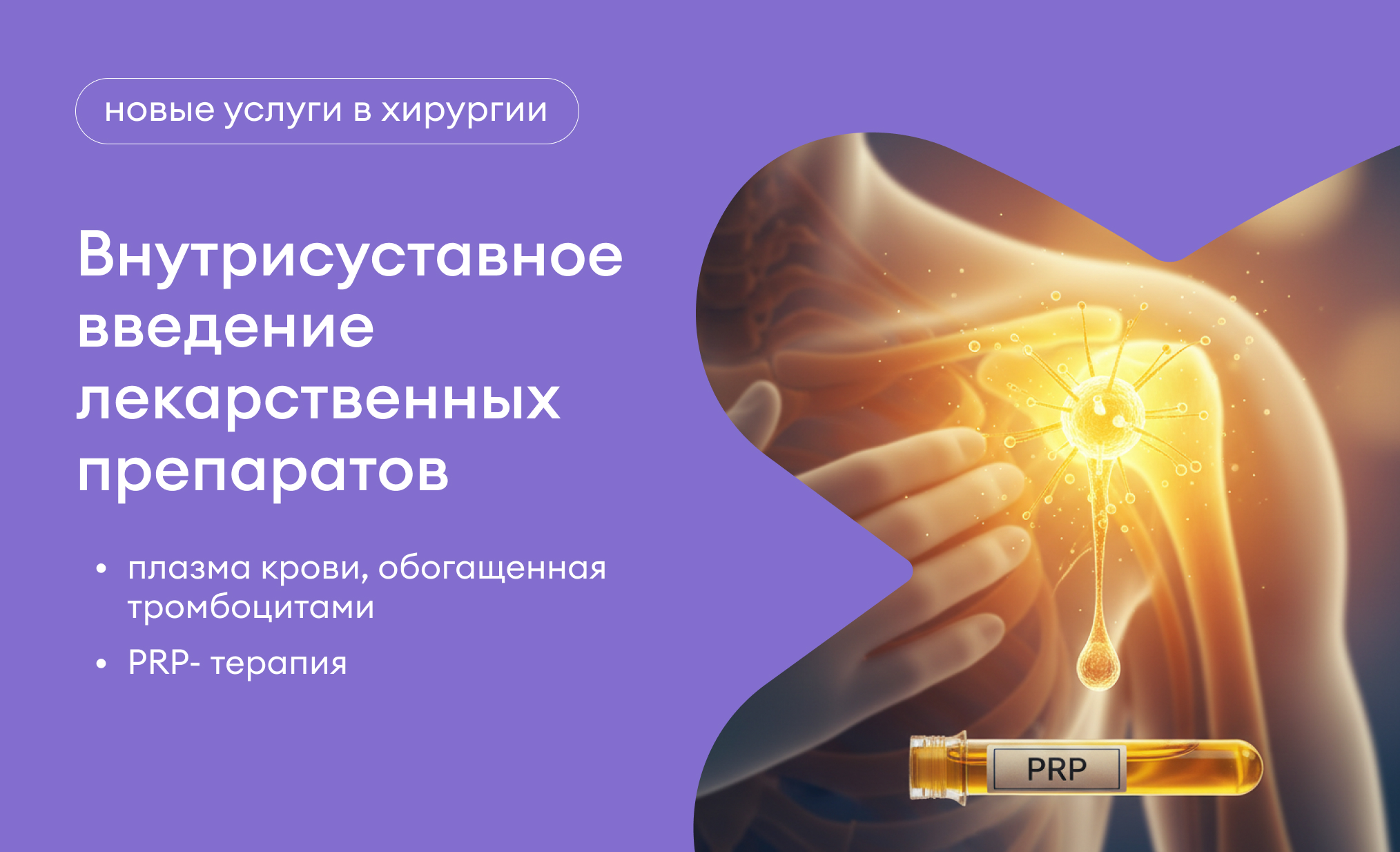 PRP-терапия в ортопедии: возможности аутологичной регенерации суставного хряща и периартикулярных тканей