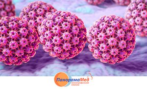 Рак, который можно предотвратить Рак, который можно предотвратить