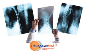 Рентген – первый шаг к здоровью
