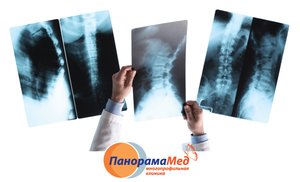 Рентген – первый шаг к здоровью Рентген – первый шаг к здоровью