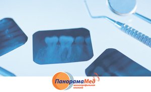 Рентген – паспорт для зуба Рентген – паспорт для зуба