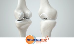 Как сберечь суставы летом Как сберечь суставы летом