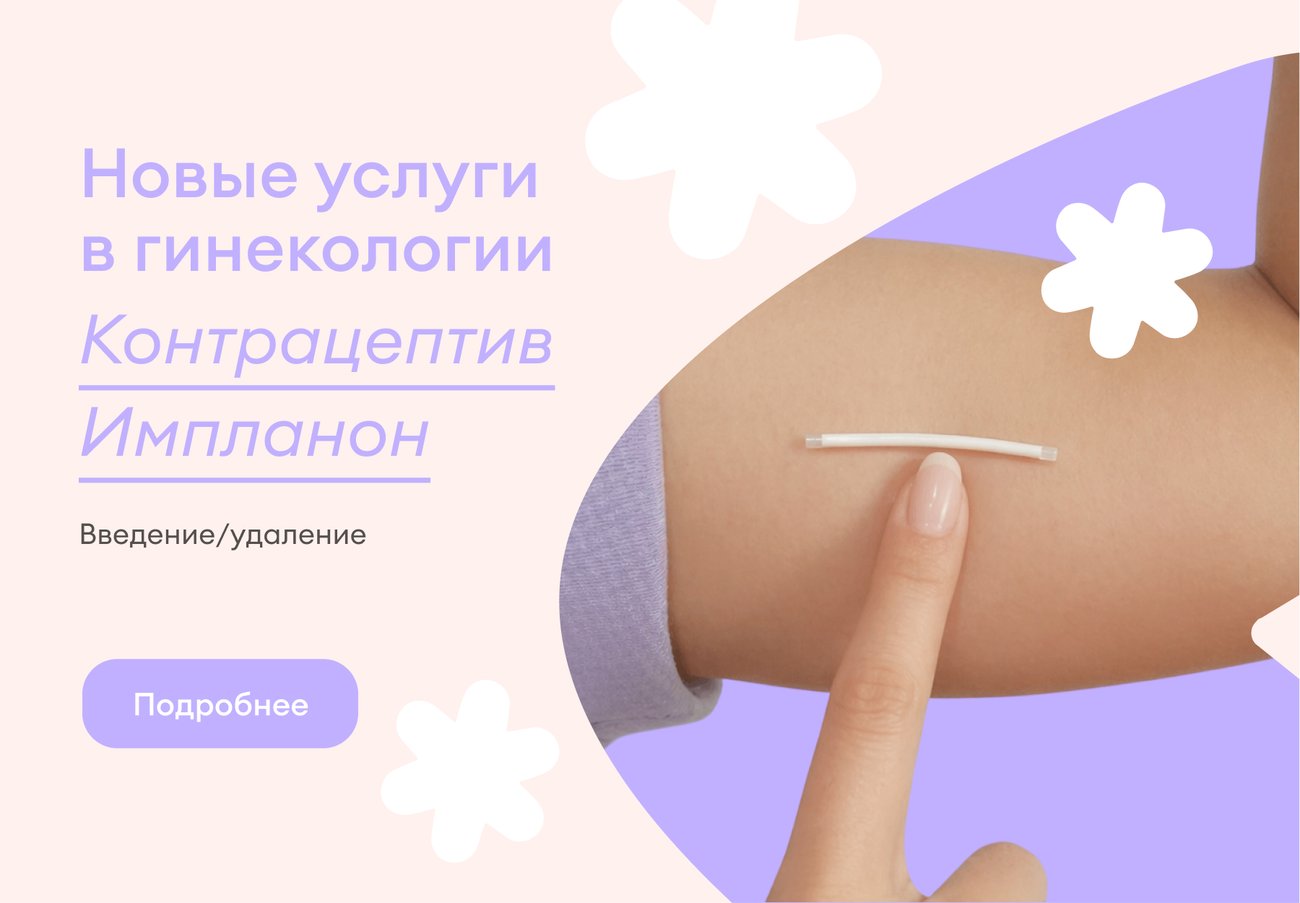 Живите без оглядки на календарь. Контрацепция длительного действия.