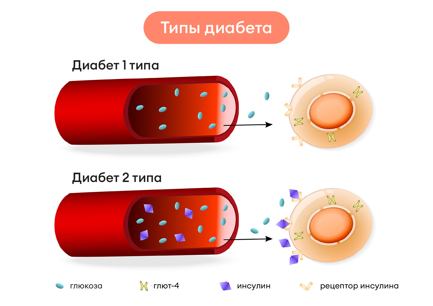 Виды диабета