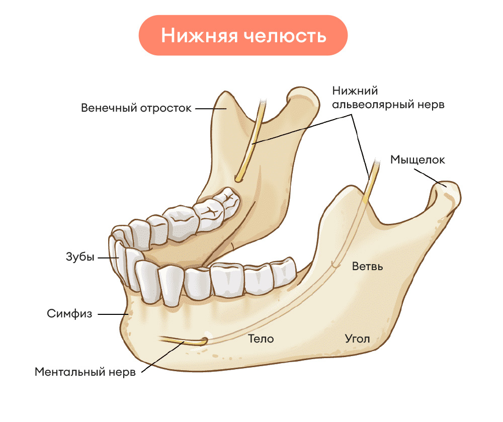 Перелом челюсти