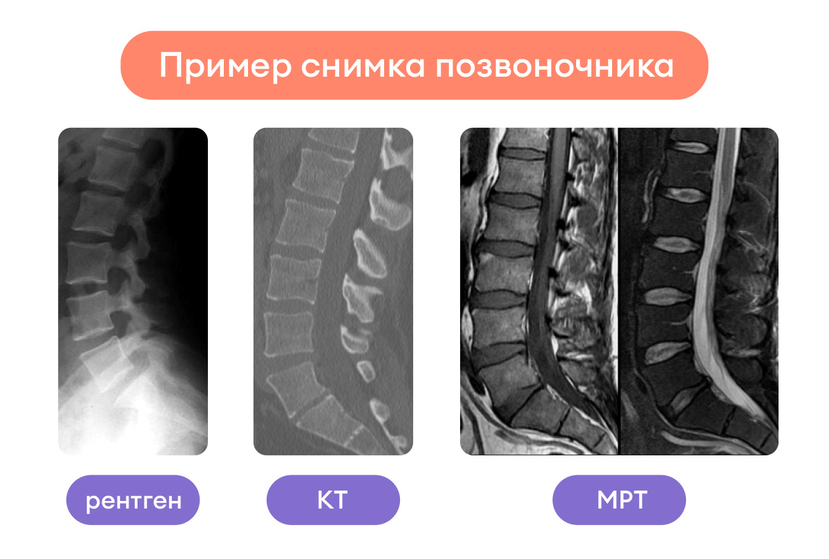 Что лучше кт мрт рентген?